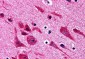 TAB2 Antibody